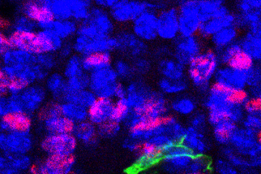  In normal intestinal conditions, after three days, quiescent stem cells (​in ​ green) d​on't divide compared to other quickly-dividing intestinal cells​ (in red)​ . (F Barriga, IRB Barcelona)