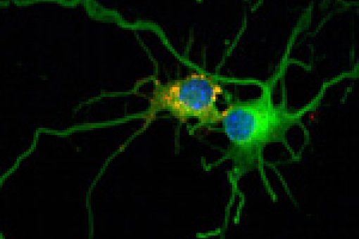 Image obtained by confocal microscopy. The accumulation of glycogen (yellow and red) in neurons caused their degradation and cell suicide ensues. (c)IRB Barcelona