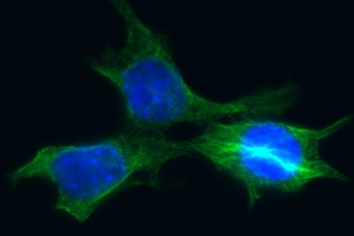 Imatge de cèl·lules de càncer de mama derivades d'un tumor de ratolí (en blau: nucli, en verd: tubulina) Crèdit: Begoña Cánovas, IRB Barcelona