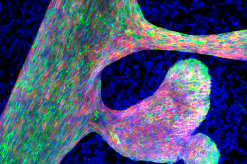 Tinció d'immunofluorescència per l'epiteli mamari (vermell), ressaltant el llinatge luminal (verd), mostrant una ramificació mamària aberrant, a causa un increment de l'accessibilitat de la cromatina. 