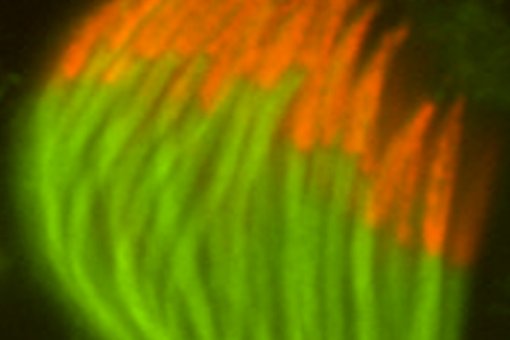 Espermatozoides de Drosophila melanogaster normal. En naranja las cabezas y en verde las colas. Foto cortesía de S. Llamazares / Gonzalez Lab