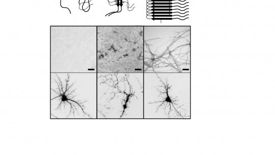 Imatges representatives de l'agregació del pèptid beta-amiloide i de l'arbre dendrític de neurones vives i mortes (Bernat Serra-Vidal, IRB Barcelona/Lluís Pujades & Daniela Rossi UB)