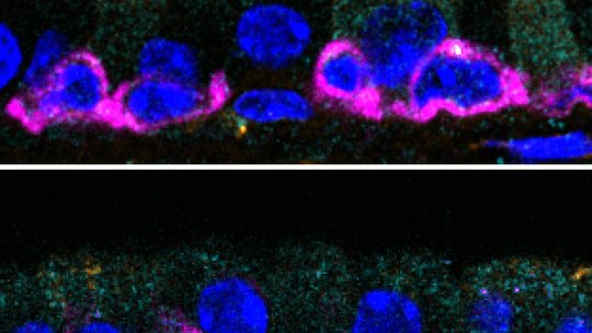 GEMC1 és necessari per generar cèl·lules multiciliades. Imatges de les tràquees de ratolins. Els cilis (en groc) són notoris en els models amb el gen GEMC1 (a dalt), mentre que els ratolins que no el tenen, no se'n generen. (Berta Terré, IRB Barcelona)