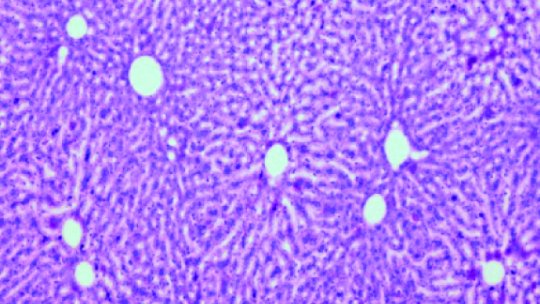 Mostra de fetge de ratolins. La imatge mostra nivells de glicogen (fúcsia) en el fetge de ratolins control, no sotmesos a cap mutació. Imatge: I. López-Soldado, IRB Barcelona 