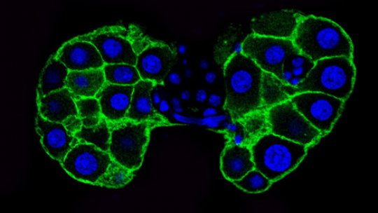 The fly prothoracic gland (in green) produces steroid hormones. © M. Milán lab, IRB Barcelona. Author: Laura Boulan