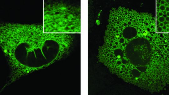 In the image, the ER of a cell with the Mfn2 protein (left) and without it. On the right, the ER form vesicles which indicates that the organelle is completely disorganized and unable to respond correctly to cellular stress (JP Muñoz)