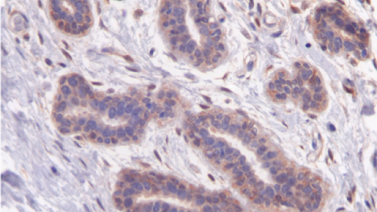 Tejido de mama no tumoral con niveles normales de LIPG (F Slebe, IRB Barcelona)