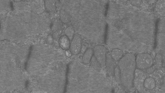 Acumulació patològica de mitocondris en múscul esquelètic de ratolí deficient d'Opa1. Aida Rodríguez, IRB Barcelona