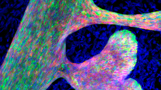 Tinció d'immunofluorescència per l'epiteli mamari (vermell), ressaltant el llinatge luminal (verd), mostrant una ramificació mamària aberrant, a causa un increment de l'accessibilitat de la cromatina. 