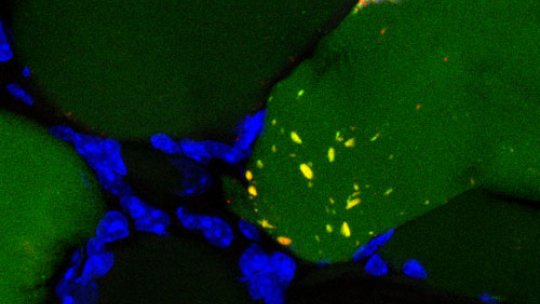 Presence of DOR (red) in mouse muscle fiber. The picture shows autophagosomes (green) that start autophagy and DOR (red), which is involved in the process (Author: D Sala, IRB)