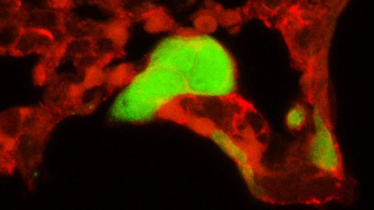 In black, the lung. in green, tumour cells dividing in the lung. In red, blood vessels, which hold other tumour cells (small green/yellow dots) that have not moved into the lung yet. (Microscope image: J Urosevic, IRB)