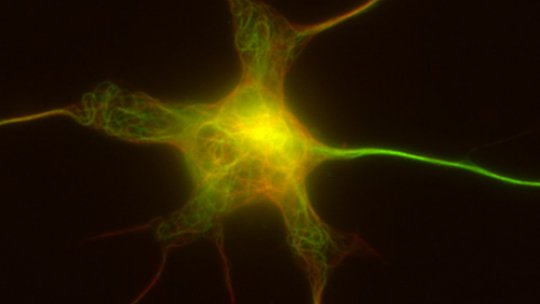 Imatge de microscòpia d’una neurona de ratolí en cultiu amb la xarxa de microtúbuls en verd i vermell, segons modificacions químiques. L’axó, en verd més intens, és l’extensió nerviosa que té més microtúbuls modificats (Carlos Sánchez-Huertas, IRB)