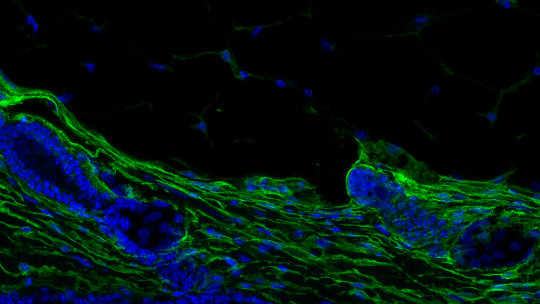 Piel envejecida de ratón. La imagen muestra una sección de la piel con los la fibroblastos marcados en verde. El grosor y la densidad celular de la dermis disminuye con el paso de los años -en azul, los núcleos celulares- (Marion Salzer, IRB Barcelona)