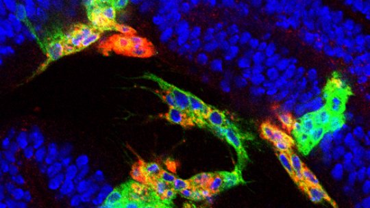 Microscopy image of motile transformed cells (in green), expressing the Matrix Metalloproteinase MMP1 (in red) and surrounded by normal epithelial cells (in blue)  © M. Milán lab, IRB Barcelona. Author: Andrés Dekanty