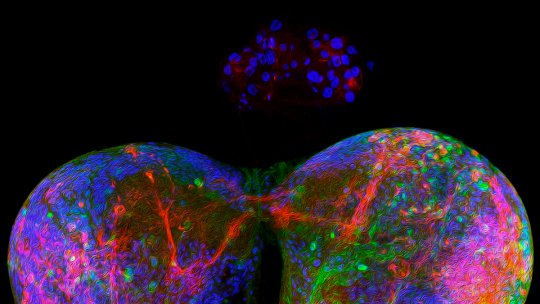 Glándula anular del cerebro de Drosophila, equivalente a la glándula protorácica humana, responsable de la producción de hormonas esteroideas.