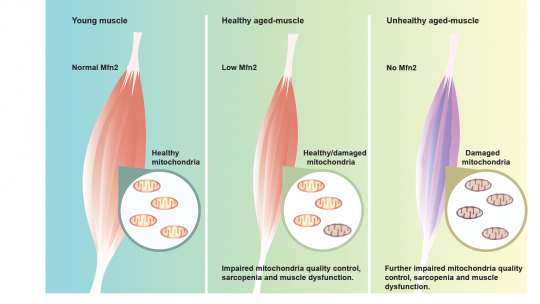 Esquema donde se muestra la relación entre diferentes niveles de expresión de Mitofusina 2 y envejecimiento muscular  (D. Sebastián, IRB Barcelona, CIBERDEM).