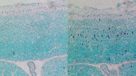 CEP63 depletion increases stem cell death in the developing mouse brain. The image on the right shows the stem dying cells in purple. The mice are born with microcephaly, a characteristic feature of Seckel Syndrome (Image: Berta Terré, IRB Barcelona)