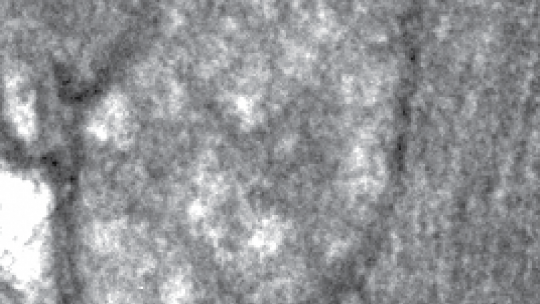Imagen de microscopia electrónica. Mitocondria de músculo sin Mitofusina 2 (D. Sebastián, IRB Barcelona, CIBERDEM)