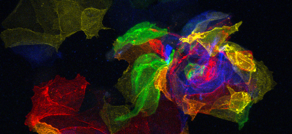 The Deadly Hurricane