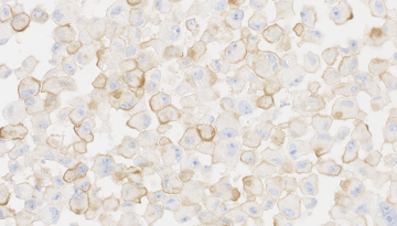  Clearing Senescence Boosts Chemotherapy