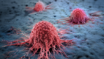 Plasticity in cancer 