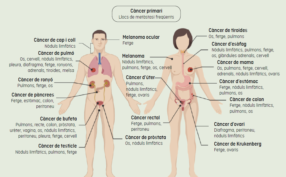 Imatge amb els òrgans vitals habitualment afectats per metàstasi segons el lloc del tumor inicial, desglossat per cos masculí i femení