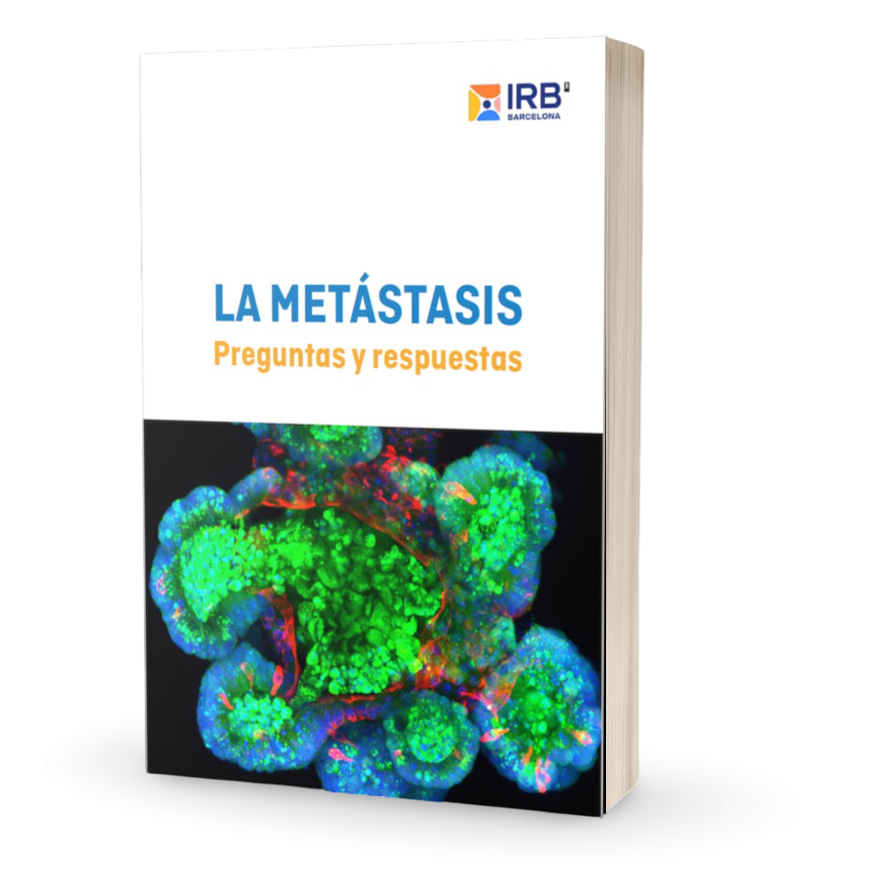 Descarga el ebook Metástasis: Preguntas y Respuestas