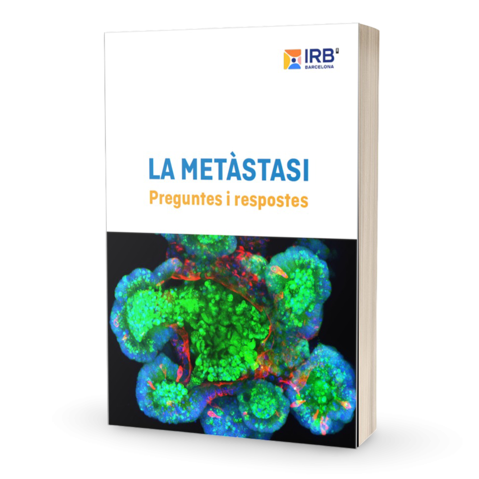 Descarrega l'ebook "La Metàstasi: Preguntes i respostes"