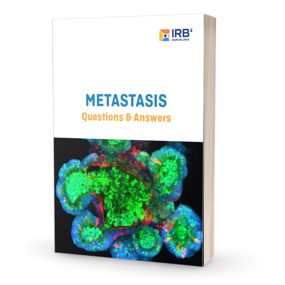 Download Metastasis: Questions and Answers eBook
