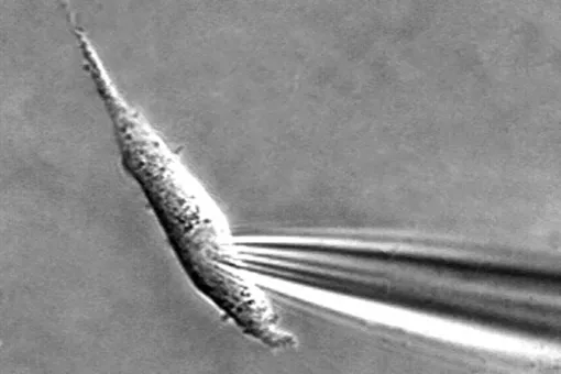 Image of a cell “ruptured” by a fire-polished micropipette