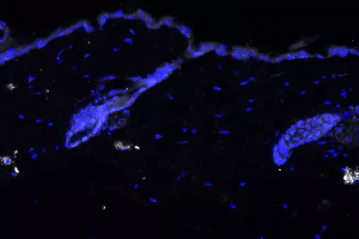 Immunofluorescence staining of IL-17(white) in aged mouse skin