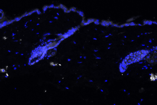 Immunofluorescence staining of IL-17(white) in aged mouse skin