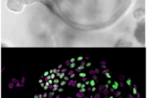 Individual intestinal stem cells generate spherical organoids when grown in lab-plates (upper pannel). Under the microscope (lower pannel), these organoids reveal to be composed mostly by undiferentiated and proliferative cells, the intestinal stem cells