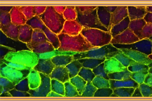 Poster of the "Cancer, Metastasis and Personalized Medicine" course