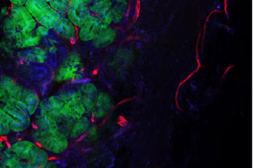 Picture of a colon tumour (Author: Eduard Batlle, IRB).