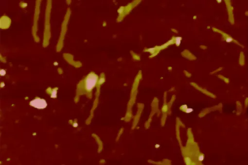 La proteína Receptor de Andrógenos forma agregados que dañan las células musculares y las neuronas motoras en la Enfermedad de Kennedy (B. Eftekharzadeh, IRB Barcelona)