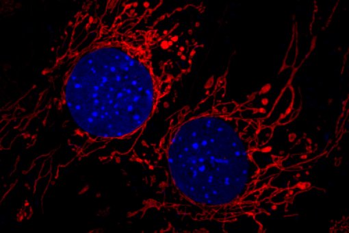  Cèl·lules amb la xarxa mitocondrial marcada en vermell. Imatge: David Sebastián, IRB Barcelona 