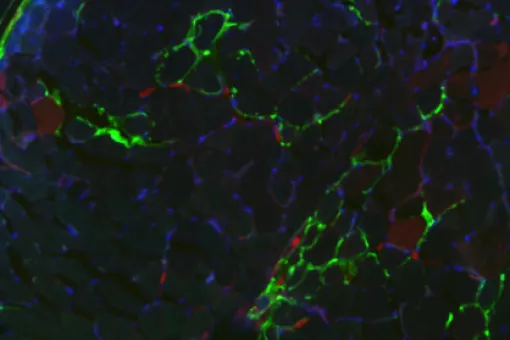 Imagen: Worldwide Cancer Research. 