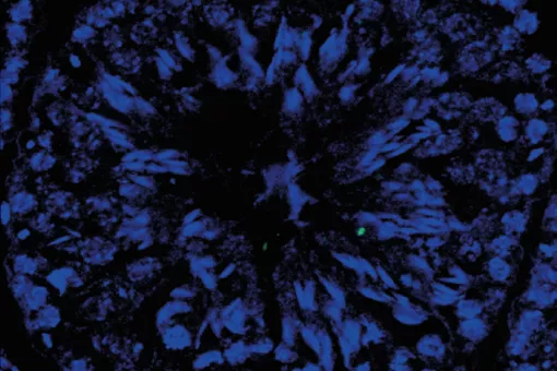 Microscopic structure of mouse testicle tissue (P.Mikolcevic, IRB Barcelona)