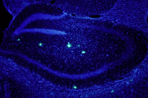 La beta amiloide està fortament vinculada a Alzheimer; encara cal revelar com hi influeix. Mostra de cervell de ratolí que sobreexpressa beta amiloide. En blau, nuclis neuronals. En verd, algunes plaques de beta amiloide (E.Verdaguer/S.Brox)