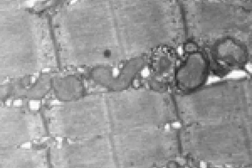Mitochondrial autophagy in skeletal muscle