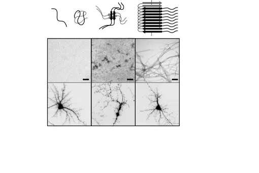 Imágenes representativas de la agregación del péptido beta-amiloide y del árbol dendrítico de neuronas vivas y muertas (Bernat Serra-Vidal, IRB Barcelona/Lluís Pujades & Daniela Rossi UB)