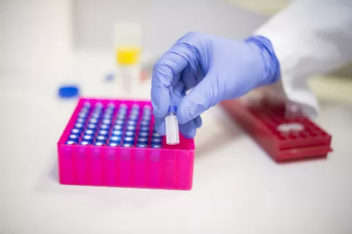 El proyecto Spark busca desarrollar un medicamento para tratar la esquizofrenia (Foto: Iproteos y G. Battista) 