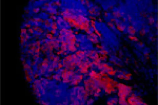 Brain tumours in larvae of the fruit fly Drosophila melanogaster express proteins that are normally expressed in germline cells (in red). (c) IRB Barcelona. C. González.