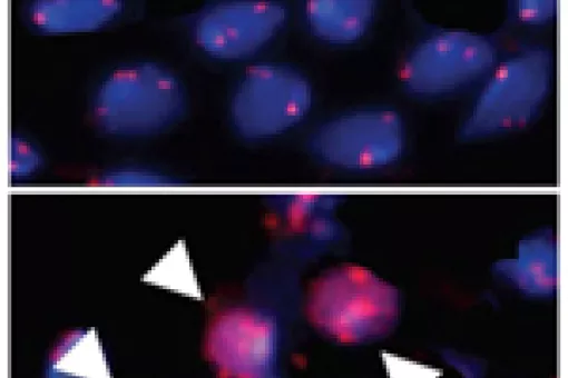 The localization of CenH3 protein in the centromere (upper panel) becomes inespecific along the chromosome (lower panel) when its regulated degradation is unpaired.