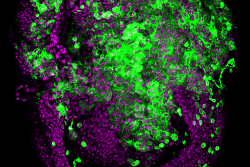  Epitelio de Drosophila sometido a inestabilidad cromosómica (CIN): las células comienzan a invadir los tejidos vecinos. En magenta, núcleos del epitelio y, en verde, membranas de las células sometidas a CIN (L Barrio, IRB Barcelona) 