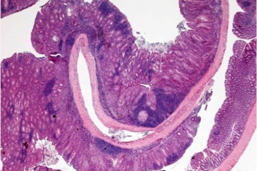 Imagen de microscopía del colon de un ratón con inflamación crónica y tumores planos (Imagen: R. Batlle)