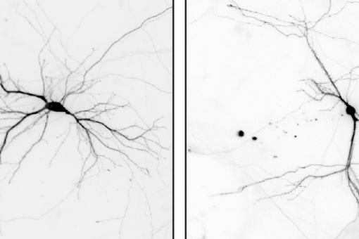   The picture shows cultured neurons prepared from brains of control mice (left) and mice in which the Nek7 gene is knocked out. The dendrites are overall shorter and less branched in NEK7 knockout neurons.