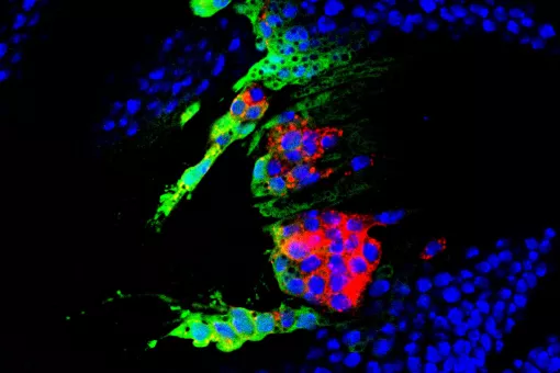 Células precursoras para formar el ala de mosca, marcadas para distintas proteínas. En este modelo, los científicos han estudiado la relación entre inestabilidad cromosómica, aneuploidía y tumorogénesis (Lara Barrio, IRB Barcelona)