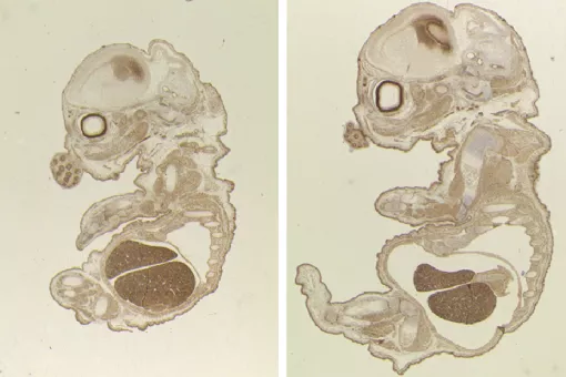 Cross sections of wild type or TLK2 deficient embryos stained for the proliferative marker Ki67. Embryos lacking TLK2 (left) appear morphologically normal but developmentally delayed. (S. Segura-Bayona, IRB Barcelona)